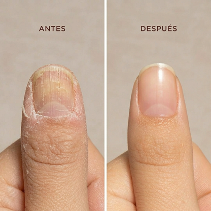 NailRestore™ – Tratamiento Reparador y Fortalecedor de Uñas