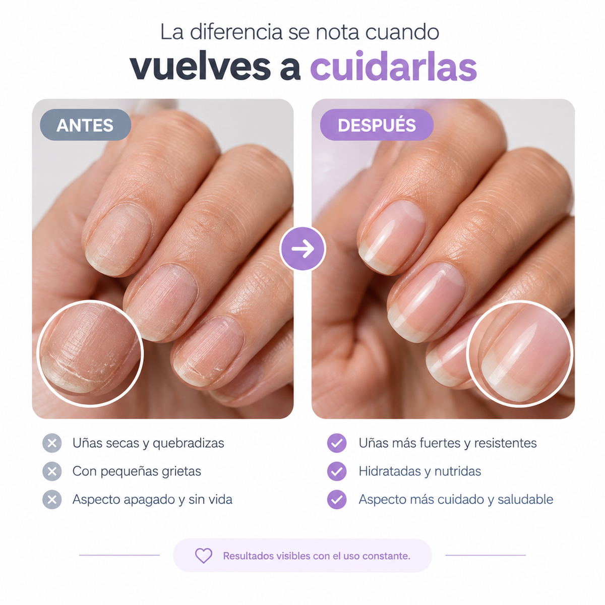 NailRestore™ – Tratamiento Reparador y Fortalecedor de Uñas