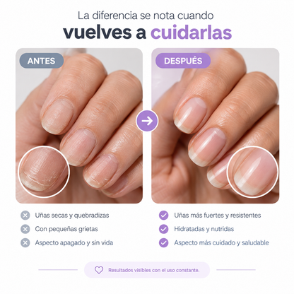 NailRestore™ – Tratamiento Reparador y Fortalecedor de Uñas
