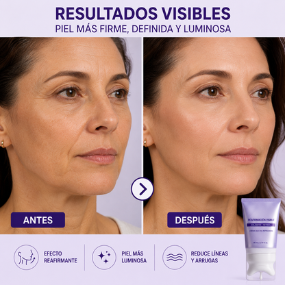 Vorya FormaLift™ - Crema reafirmante con Gua Sha integrado