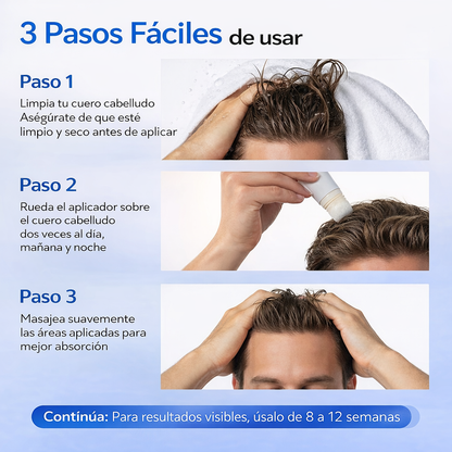 HairVive™ – Sérum Capilar Roll-On Anticaída